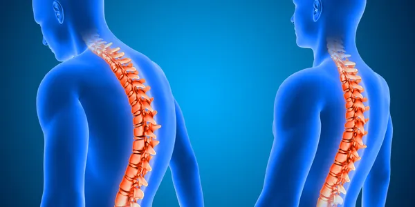 Médico mostrando radiografia da coluna