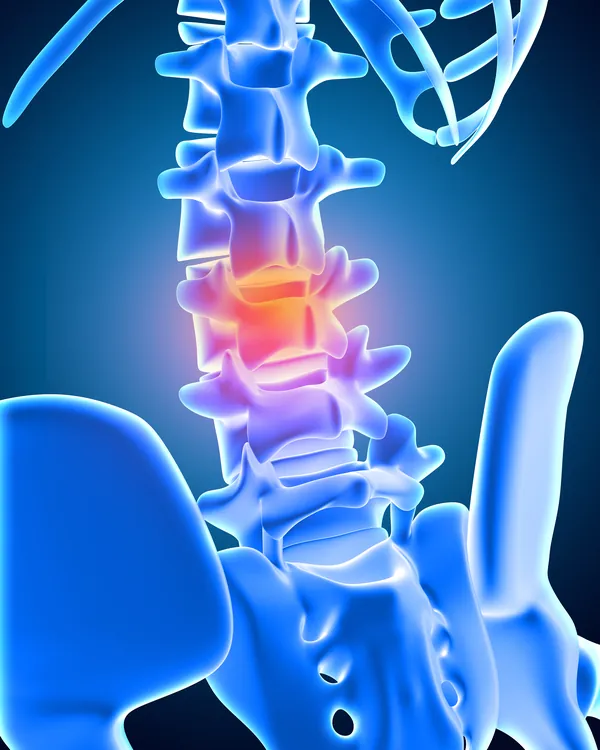 Médico analisando exame de imagem da coluna